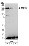 Detection of human TAB182 by western blot.