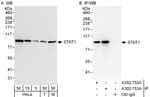 Detection of human and mouse STAT1 by western blot (h&amp;m) and immunoprecipitation (h).