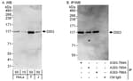 Detection of human DIS3 by western blot and immunoprecipitation.
