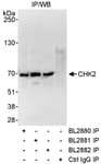 Detection of human CHK2 by western blot of immunoprecipitates.