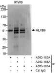 Detection of human HLXB9 by western blot of immunoprecipitates.