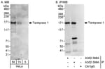 Detection of human Tankyrase 1 by western blot and immunoprecipitation.