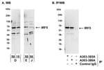 Detection of human and mouse IRF5 by western blot (h and m) and immunoprecipitation (m).
