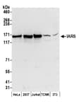 Detection of human and mouse IARS by western blot.