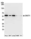 Detection of human and mouse OXCT1 by western blot.