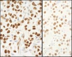 Detection of human and mouse NPM1 by immunohistochemistry.