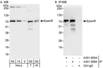 Detection of human and mouse EpsinR by western blot (h&amp;m) and immunoprecipitation (h).
