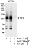 Detection of human XPC by western blot of immunoprecipitates.