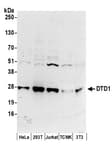 Detection of human DTD1 by western blot.