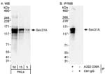 Detection of human Sec31A by western blot and immunoprecipitation.