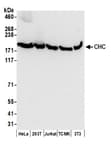 Detection of human and mouse CHC by western blot.