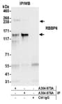 Detection of human RBBP6 by western blot of immunoprecipitates.