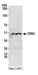 Detection of human CSN2 by western blot.