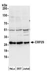 Detection of human ERP29 by western blot.