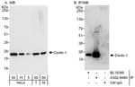 Detection of human and mouse Derlin-1 by western blot (h&amp;m) and immunoprecipitation (h).