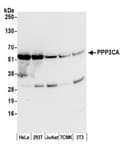Detection of human and mouse PPP3CA by western blot.