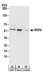 Detection of human RRP8 by western blot.