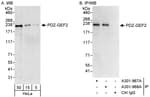 Detection of human PDZ-GEF2 by western blot and immunoprecipitation.
