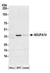 Detection of human NDUFA10 by western blot.