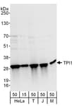Detection of human and mouse TPI1 by western blot.