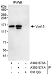 Detection of human Vps15 by western blot of immunoprecipitates.