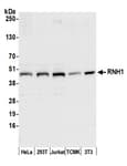 Detection of human and mouse RNH1 by western blot.