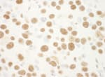 Detection of mouse NPM1 by immunohistochemistry.