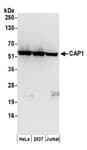 Detection of human CAP1 by western blot.
