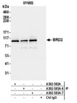 Detection of human BRD2 by western blot of immunoprecipitates.