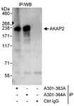 Detection of human AKAP2 by western blot of immunoprecipitates.