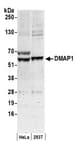Detection of human DMAP1 by western blot.