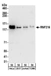 Detection of human and mouse RNF216 by western blot.