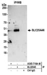 Detection of human SLC25A46 by western blot of immunoprecipitates.