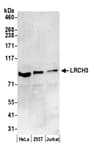 Detection of human LRCH3 by western blot.
