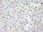 Detection of mouse MED12 by immunohistochemistry.