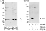 Detection of human and mouse Tip41 by western blot (h &amp; m) and immunoprecipitation (h).