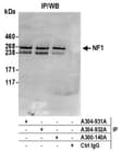 Detection of human NF1 by western blot of immunoprecipitates.