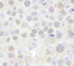 Detection of mouse CHD3 by immunohistochemistry.