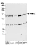 Detection of human FANCI by western blot.