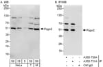 Detection of human and mouse Pygo2 by western blot (h&amp;m) and immunoprecipitation (h).