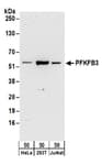 Detection of human PFKFB3 by western blot.