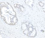 Detection of human EHMT1 by immunohistochemistry.