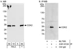 Detection of human CDK2 by western blot and immunoprecipitation.