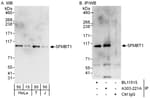 Detection of human SFMBT1 by western blot and immunoprecipitation.
