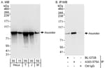 Detection of human and mouse Asunder by western blot (h and m) and immunoprecipitation (h).