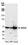 Detection of human ANXA6 by western blot.