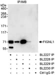 Detection of human FIGNL1 by western blot of immunoprecipitates.
