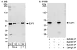 Detection of human E2F1 by western blot and immunoprecipitation.