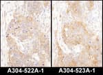 Detection of mouse COPB2 by immunohistochemistry.