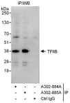 Detection of human GTF2B/ TFIIB by western blot of immunoprecipitates.